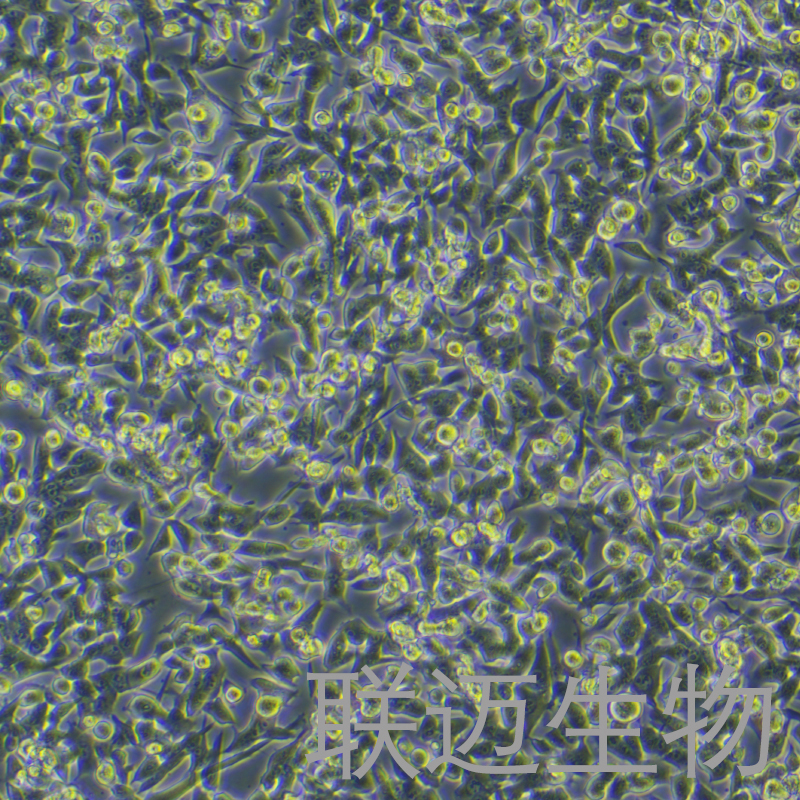 RM-1-LUC细胞（小鼠前列腺癌细胞带荧光素酶）LM8C0198-L