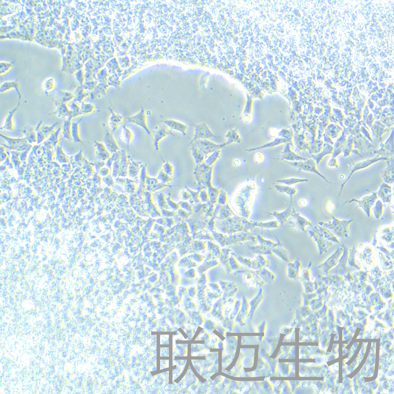 SK-ES-1细胞（人尤因肉瘤）LM8C1430