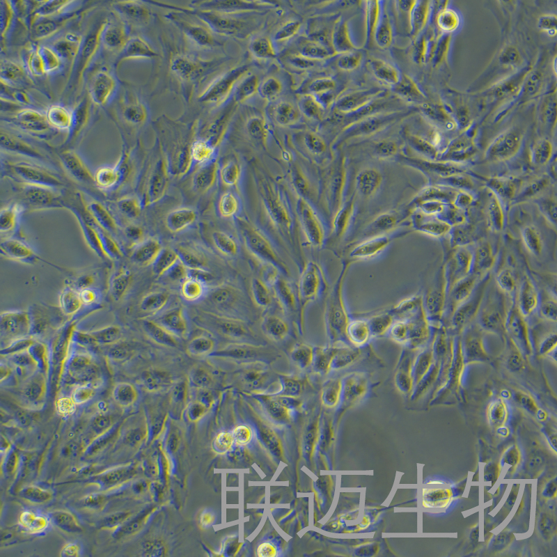 ?SKN细胞（人子宫平滑肌肉瘤细胞）LM8C1431