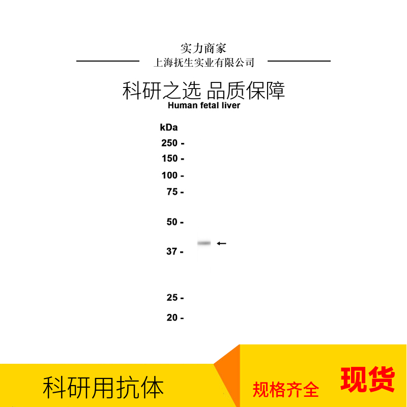 甲基转移酶样蛋白14抗体