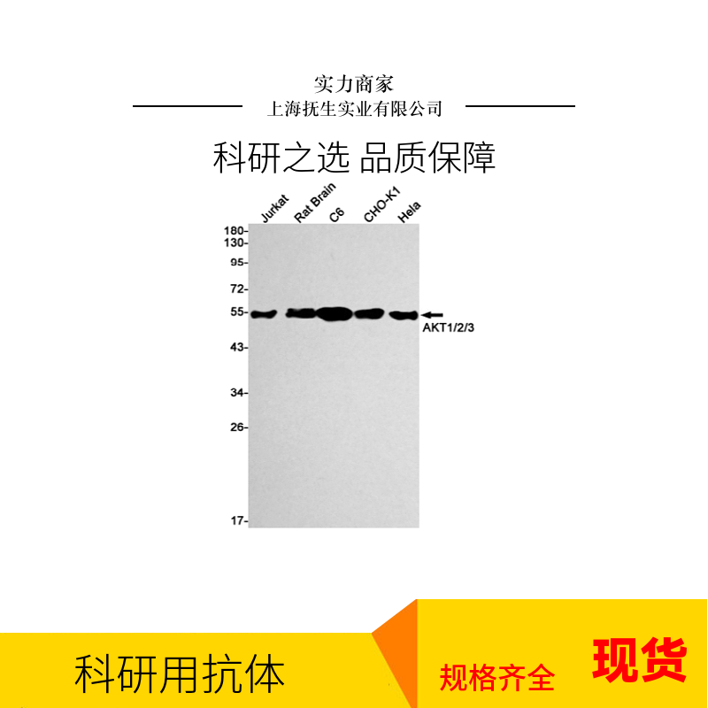 半乳糖凝集素3抗体