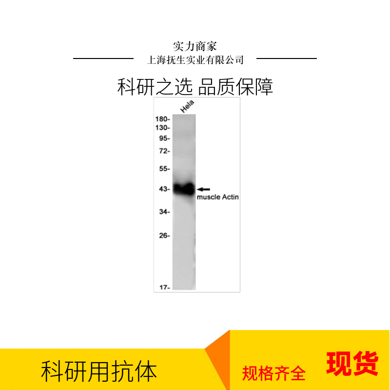 胞质接头蛋白Keap1抗体