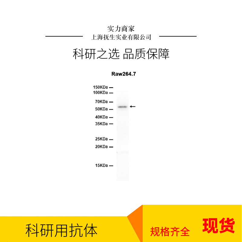 表皮生长因子受体抗体