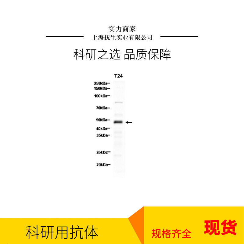 丙酮酸脱氢酶E2抗体