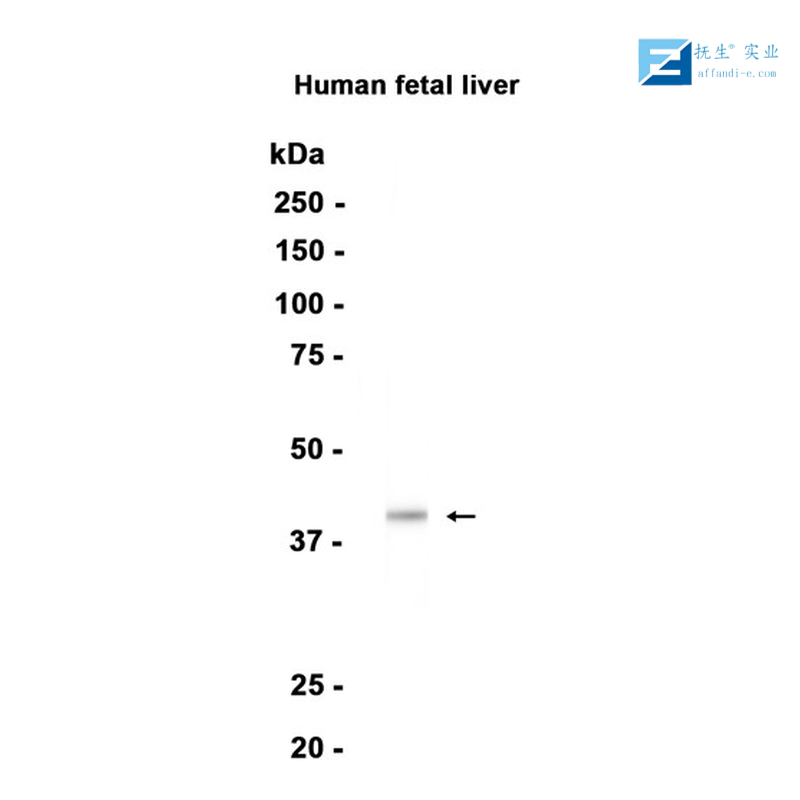 促黄体生成素受体抗体