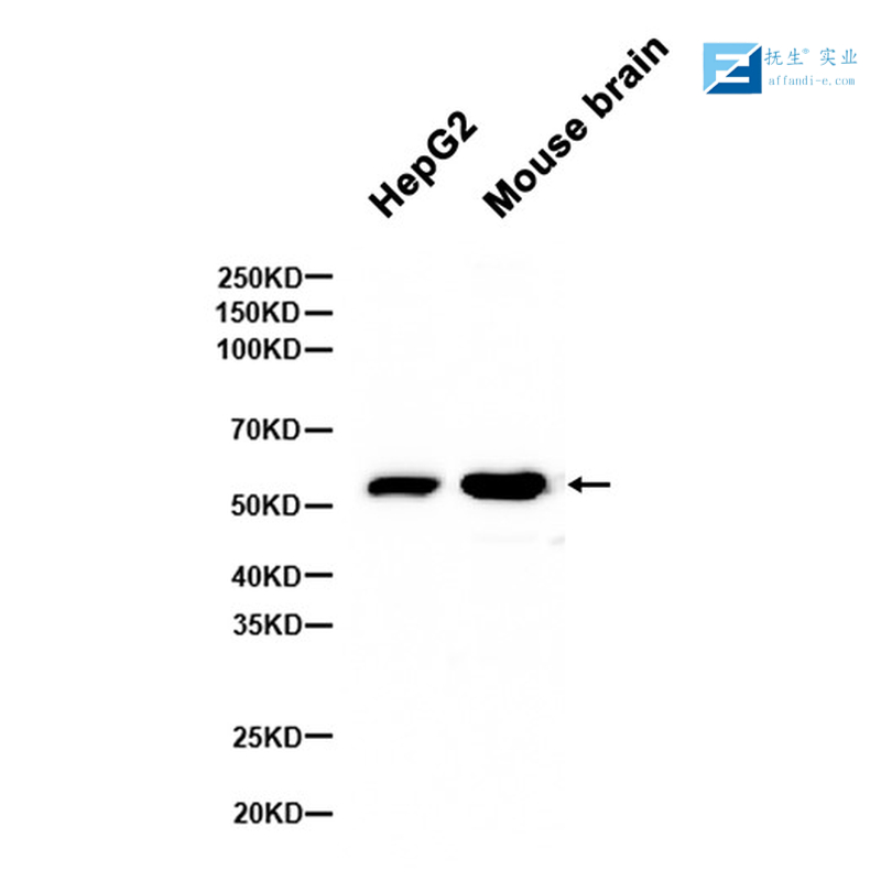 过氧化物酶体增殖物激活受体γ辅激活子1α+β抗体