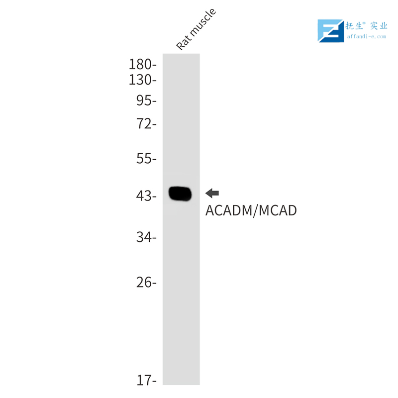 过氧化物酶体增殖物激活受体γ辅激活子1β