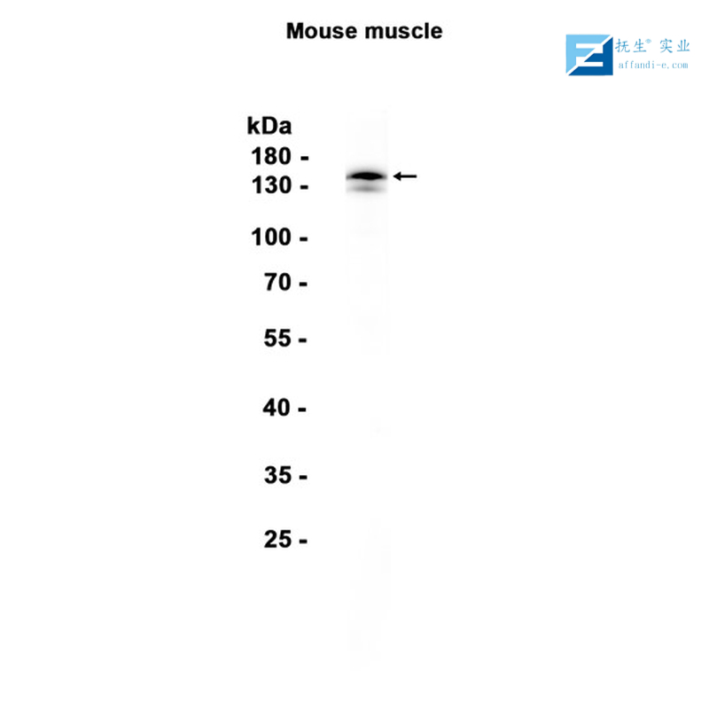 核有丝分裂器NuMA蛋白抗体
