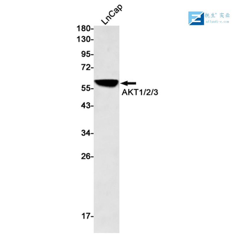 核转录因子NF-κB受体抗体(核因子kB受体活化因子)