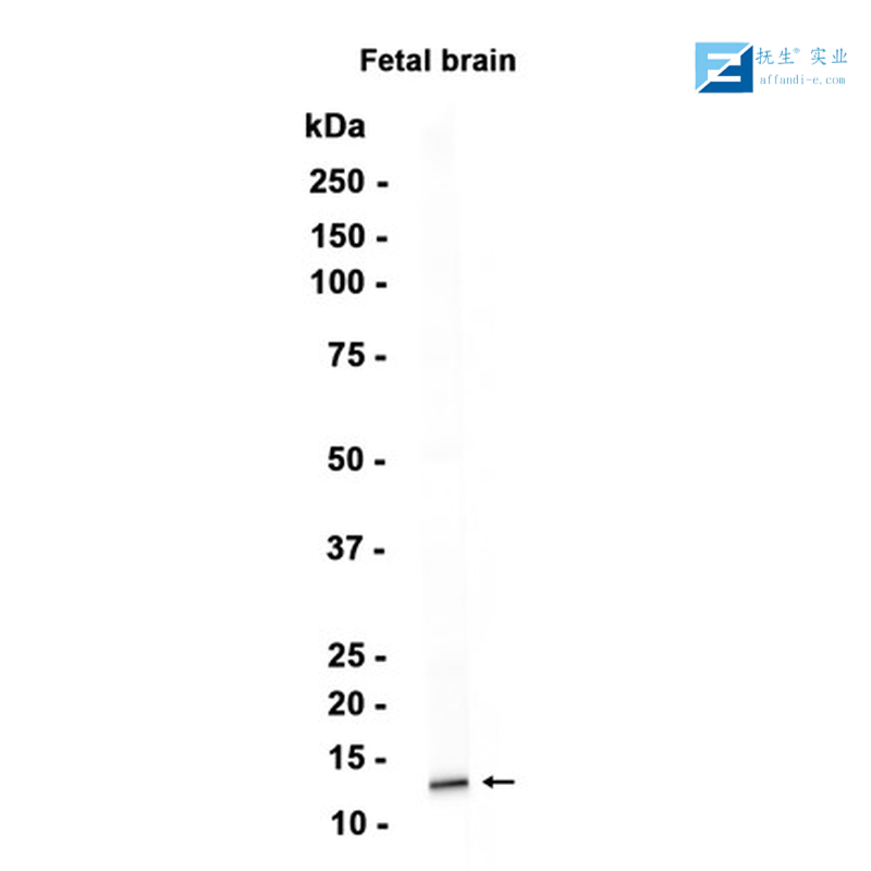 黑色素瘤生长刺激活性蛋白α/GROa抗体