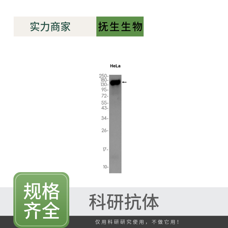 白介素1受体1抗体