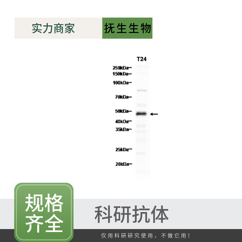 白细胞介素34抗体