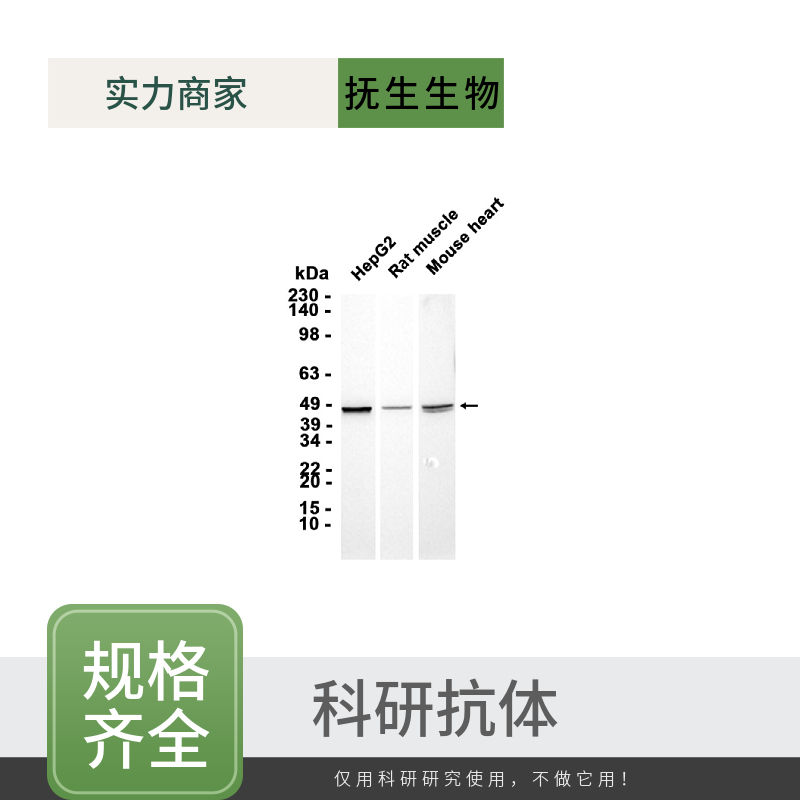 白血病相关蛋白5抗体