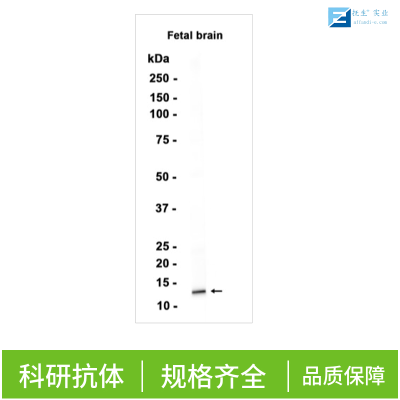 癌胚抗原相关细胞粘附分子8抗体
