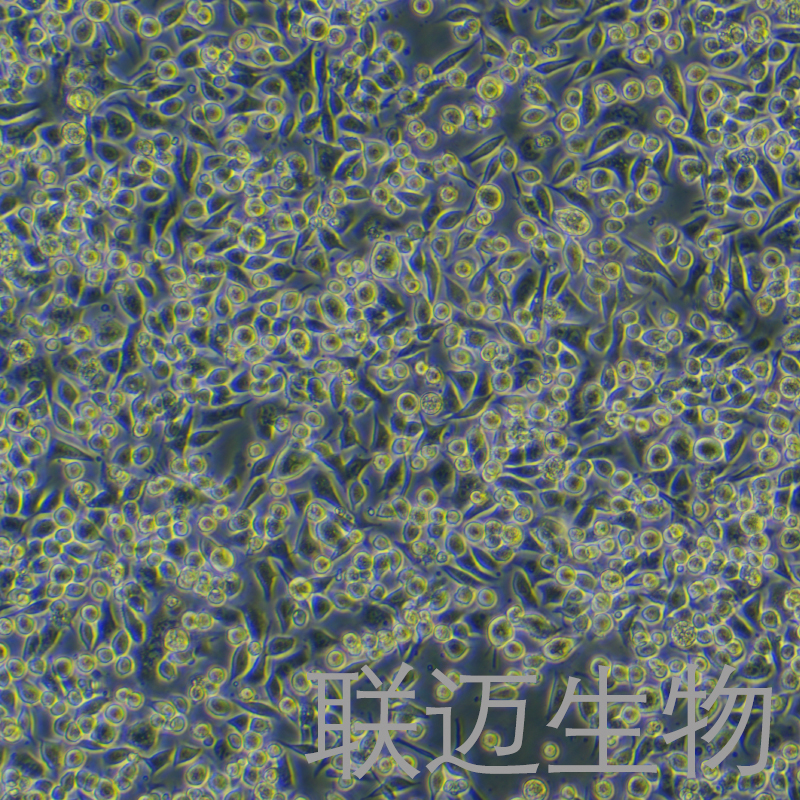 SNU-601细胞（人胃癌细胞）LM8C1435