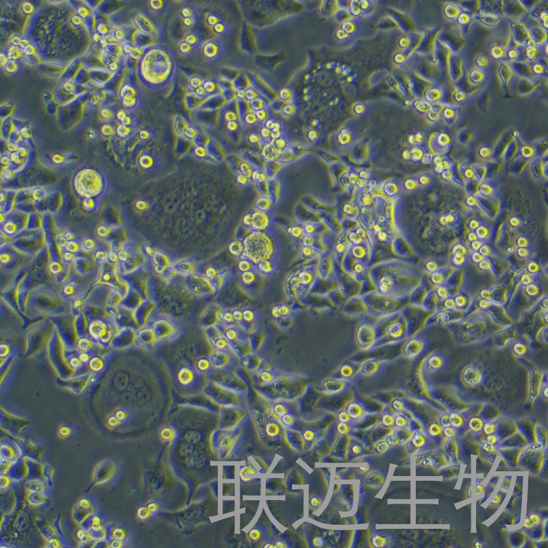 SNU-C2A细胞（人结肠癌细胞）LM8C1437