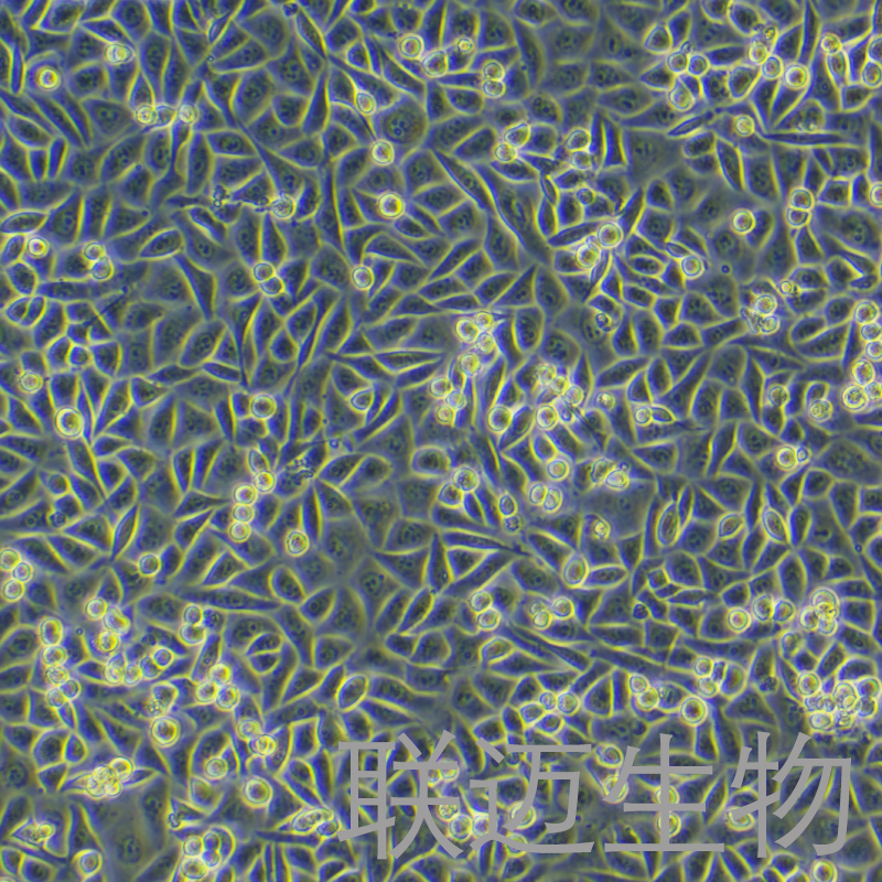 T24/DDP细胞（人膀胱癌顺铂耐药株）LM8C0307D