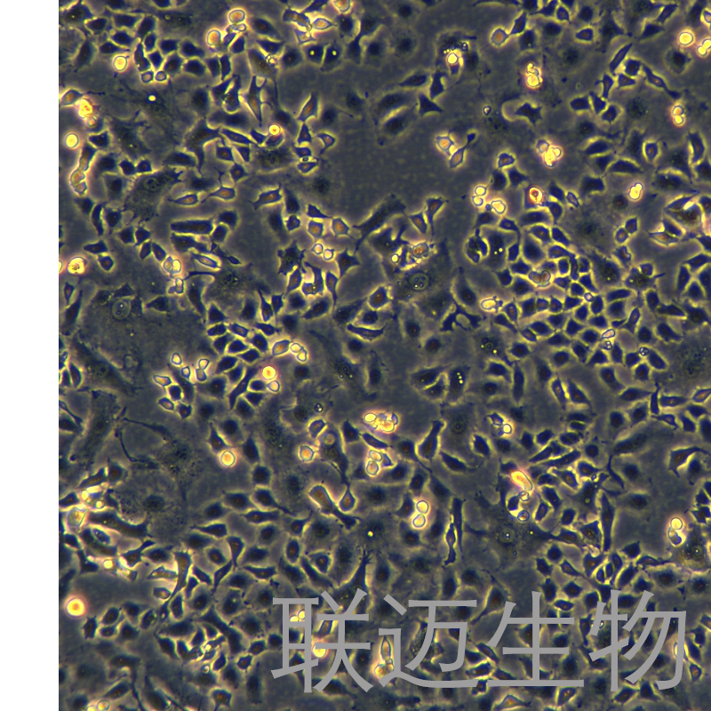 TOV21G细胞（人卵巢癌细胞）LM8C1448