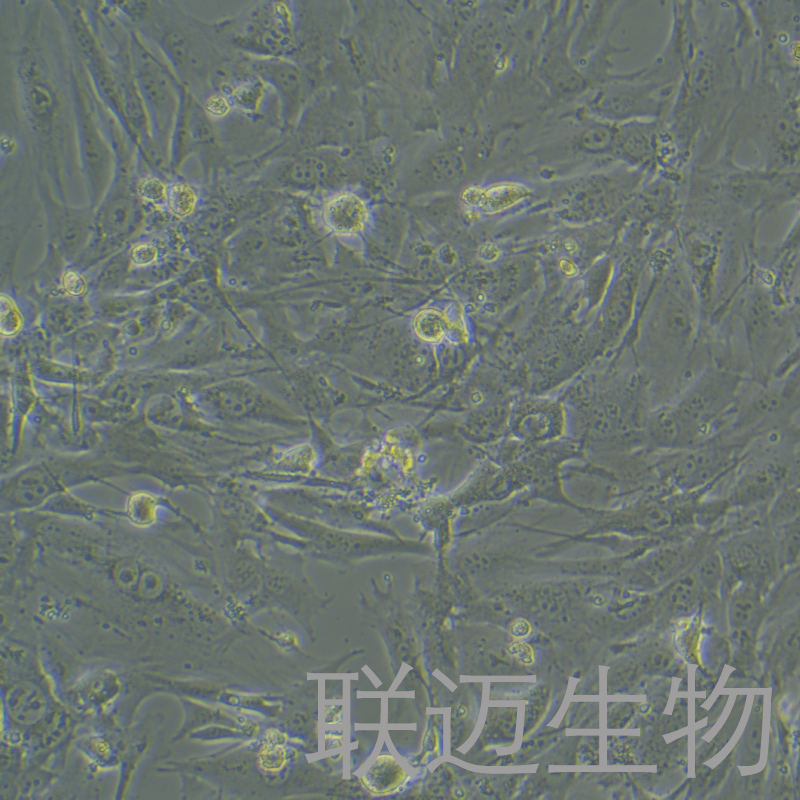 TRAMP-C1细胞（小鼠前列腺癌上皮细胞）LM8C1449