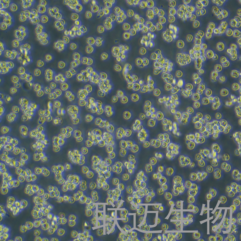 U-2932-GFP细胞（人B淋巴细胞带绿色荧光）LM8C1244-G