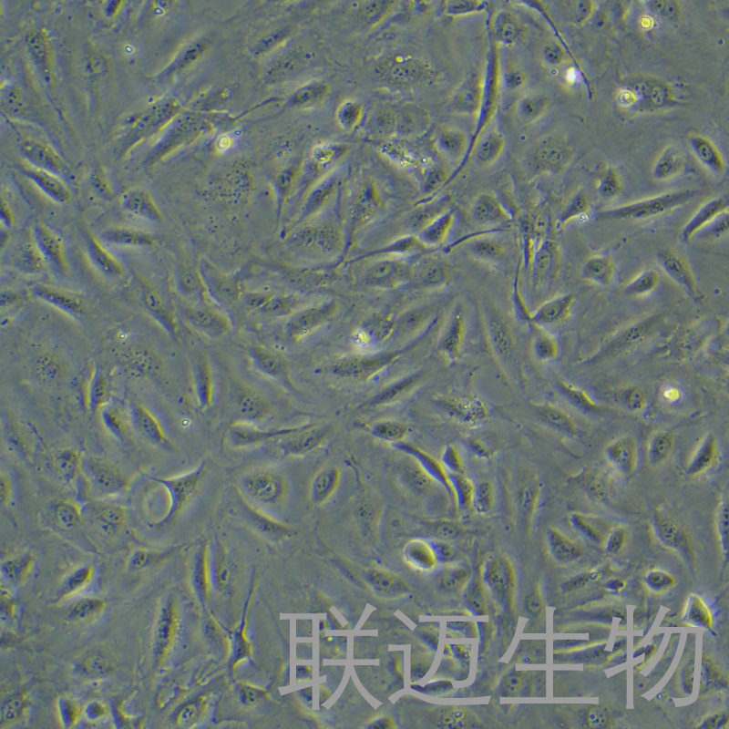 人肺微血管内皮细胞永生化细胞 LM8PC075HE