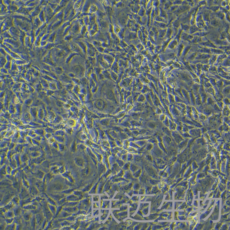 人主动脉内皮细胞永生化细胞 LM8PC057HE