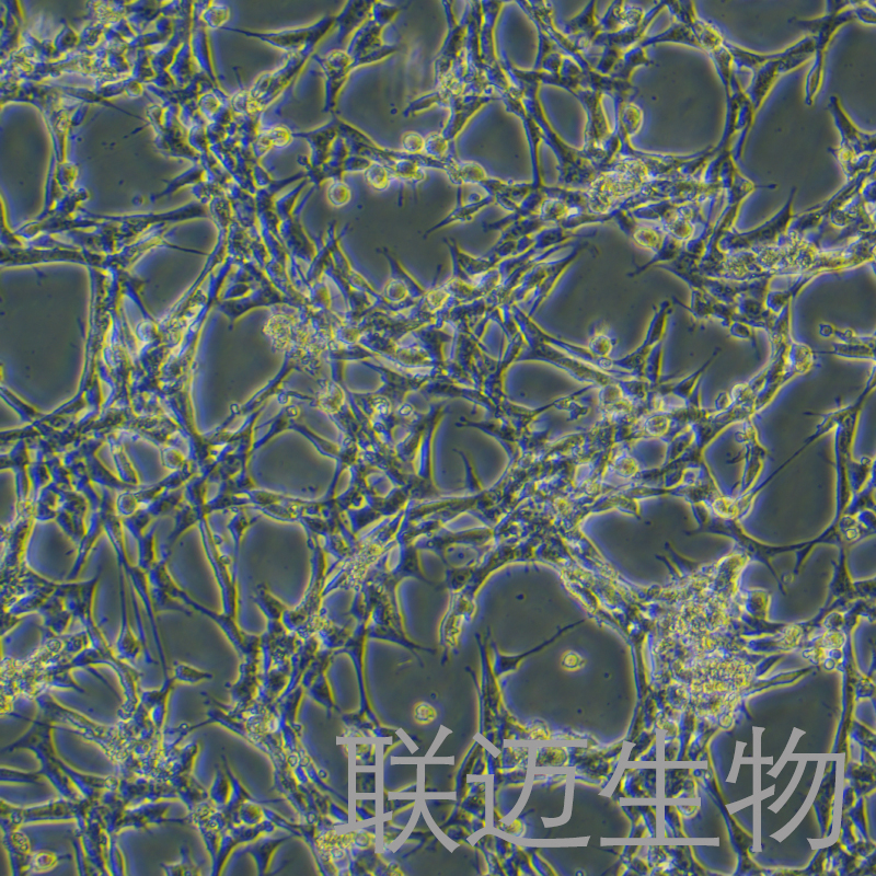 小鼠肝星状细胞永生化细胞 LM8PC064ME