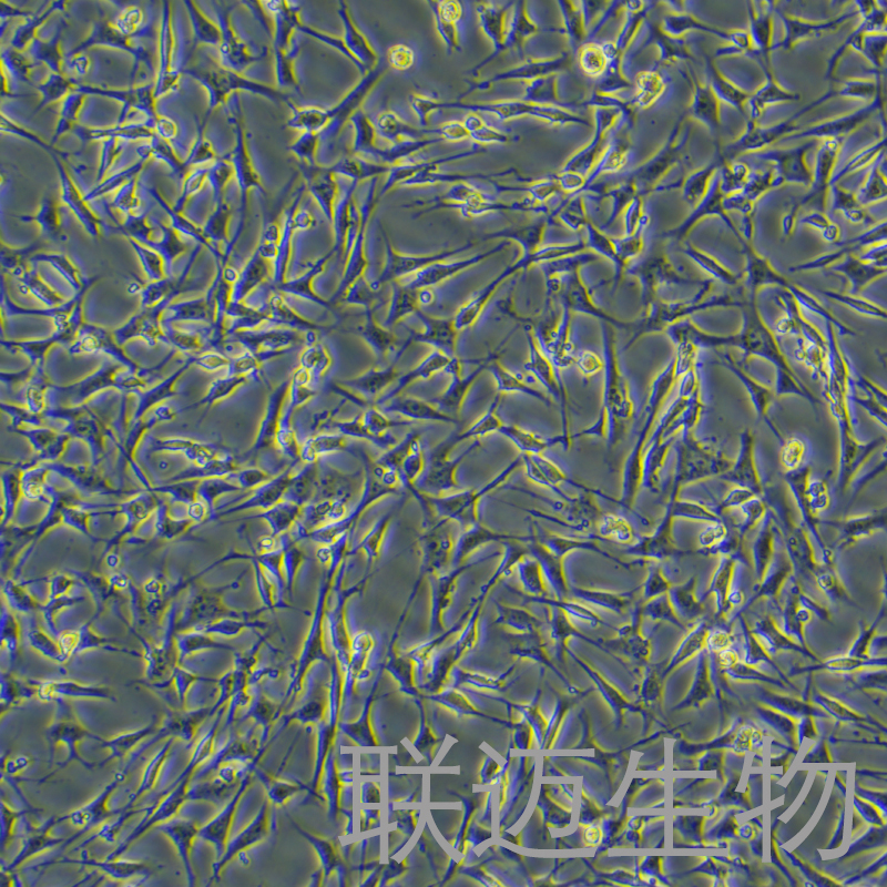 小鼠胰腺星状细胞永生化细胞 LM8PC066ME