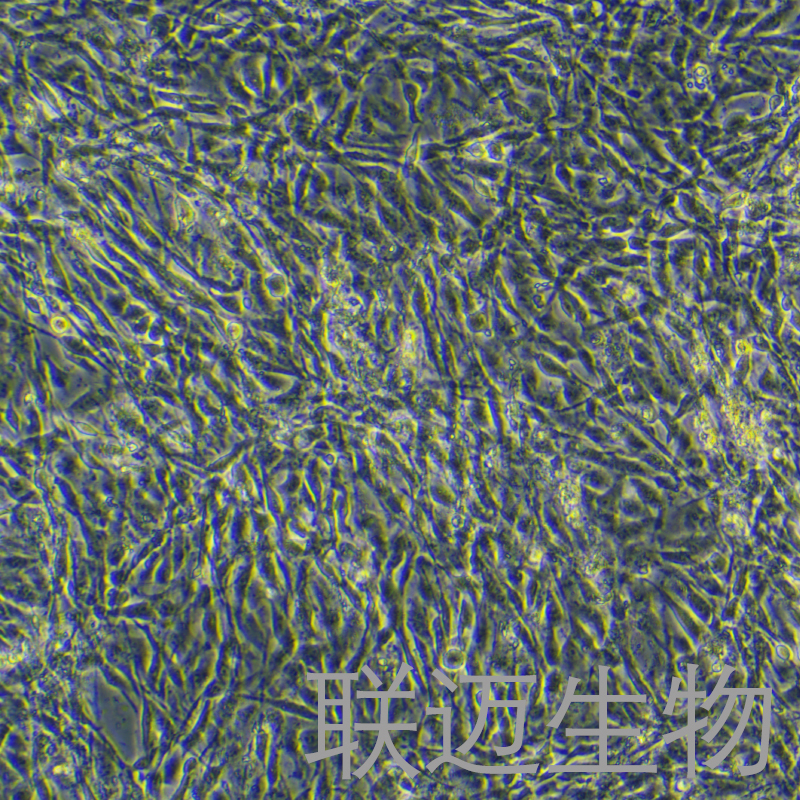 人甲状旁腺细胞永生化细胞 LM8PC088HE