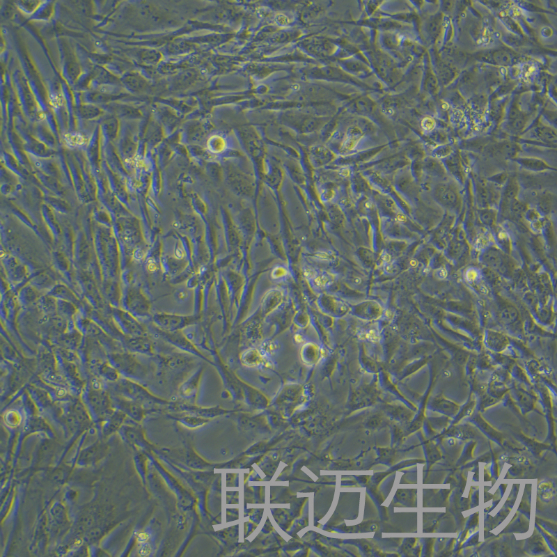 人乳腺癌成纤维细胞永生化细胞 LM8PC092HE