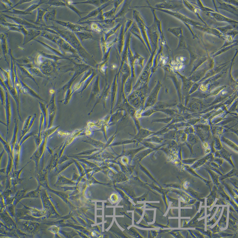 人软骨细胞永生化细胞 LM8PC093HE