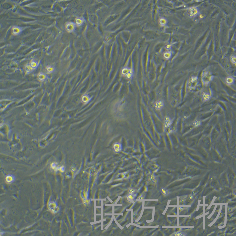 人支气管平滑肌细胞永生化细胞 LM8PC102HE