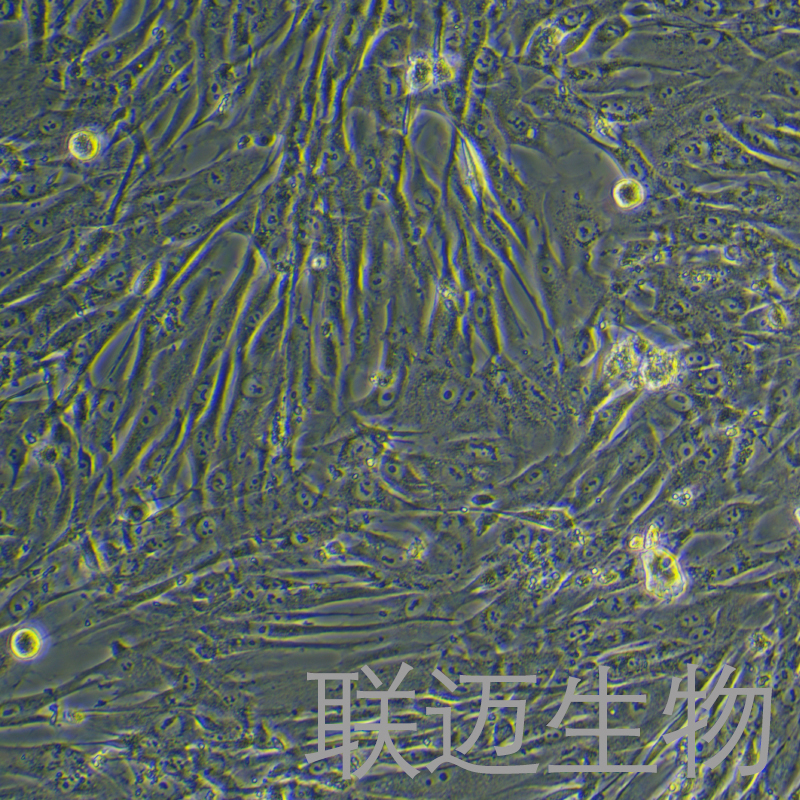 人主动脉瓣膜间质细胞永生化细胞 LM8PC103HE