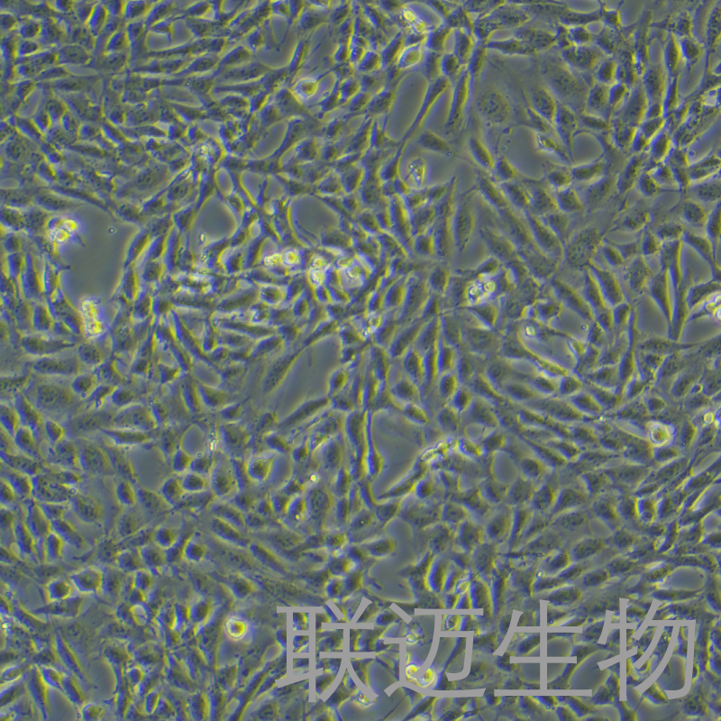 小鼠肺动脉内皮细胞永生化细胞 LM8PC071ME