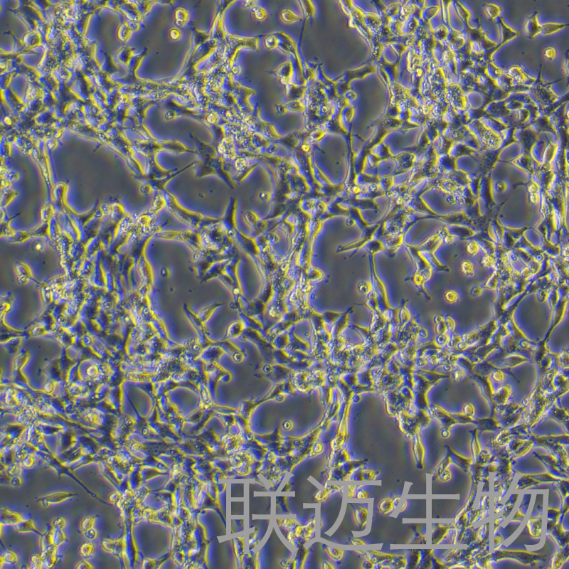 小鼠结肠黏膜上皮细胞永生化细胞 LM8PC076ME