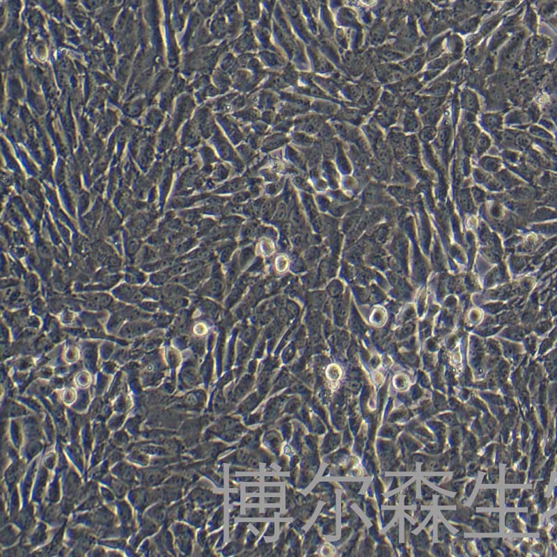 A2058细胞（人类转移性黑色素瘤）