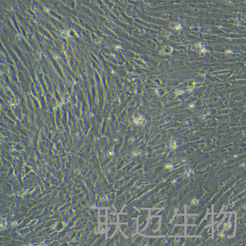 人脉络丛上皮细胞永生化 LM8PC104HE