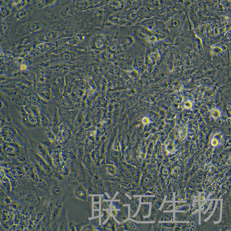 WT 9-7（人常染色体多囊肾病上皮细胞）LM8C1461