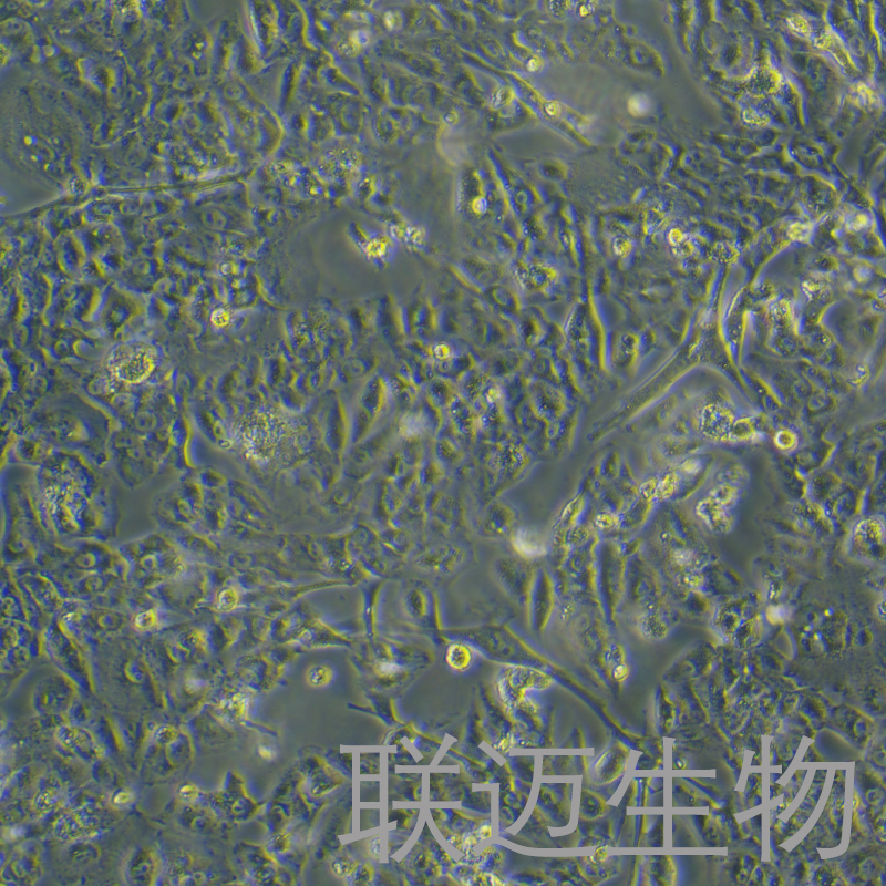 VMRC-RCW（肾细胞癌）LM8C1464