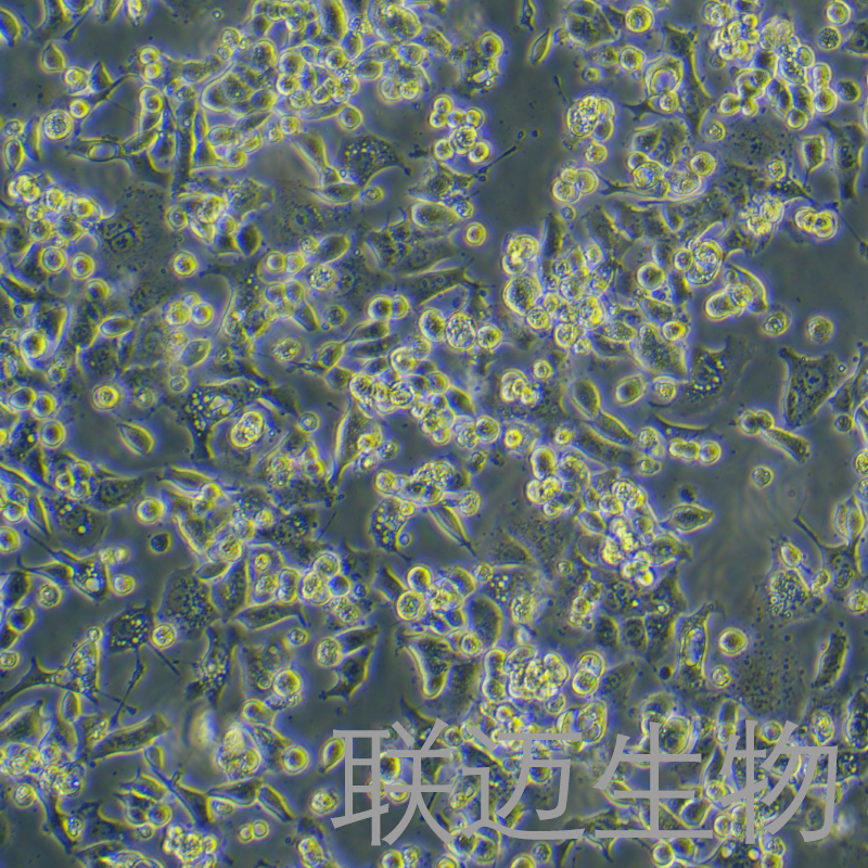 ABC1细胞（人肺腺癌细胞）LM8C1466