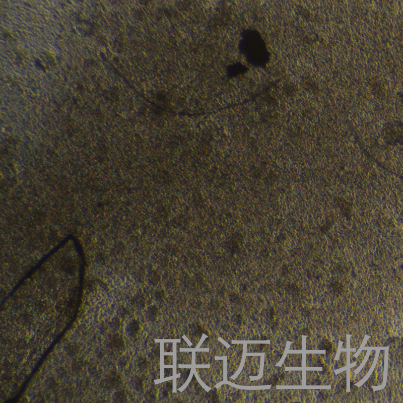 DL-40细胞（人大细胞淋巴瘤）LM8C1467