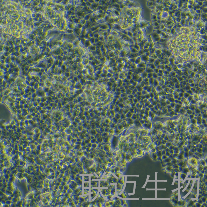 QGP-1细胞（人胰腺癌细胞）LM8C1476