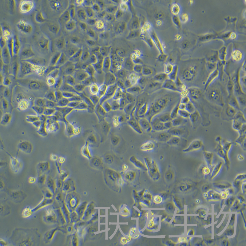 SUM149PT细胞（人乳腺癌细胞）LM8C1477