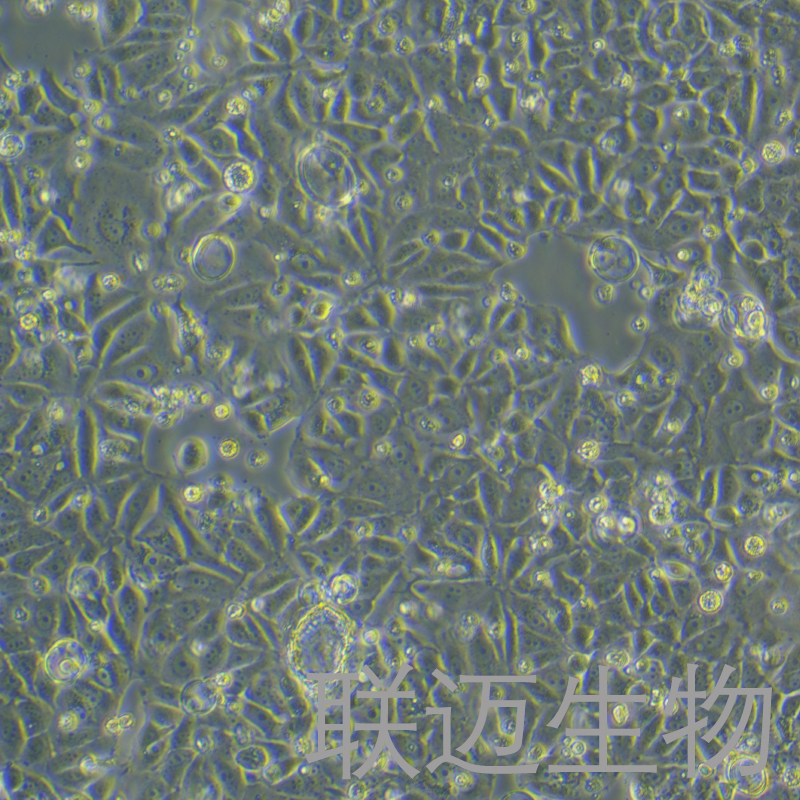 MCF-7/TAM细胞（人乳腺癌他莫昔芬耐药细胞）LM8C0149D4