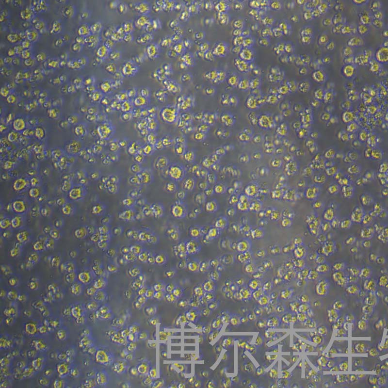 KMS-21BM（人多发性骨髓瘤细胞）