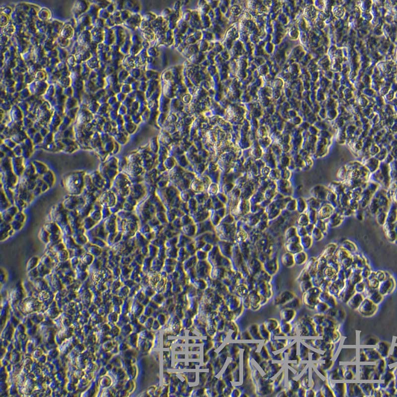 QGP-1（人胰腺癌细胞）