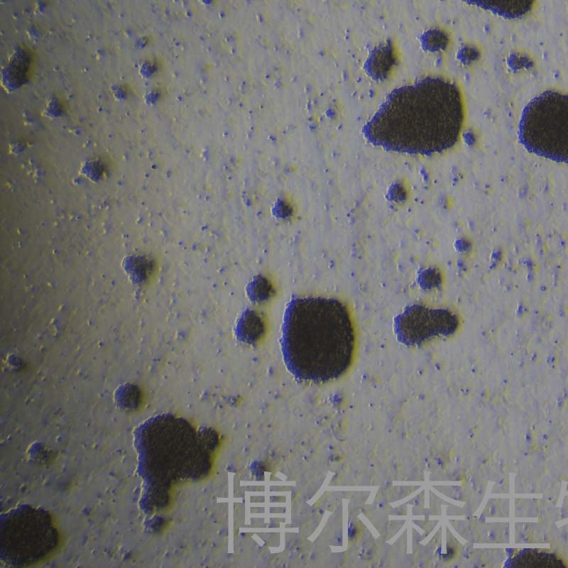 Hs 611.T（人霍奇金淋巴瘤细胞）