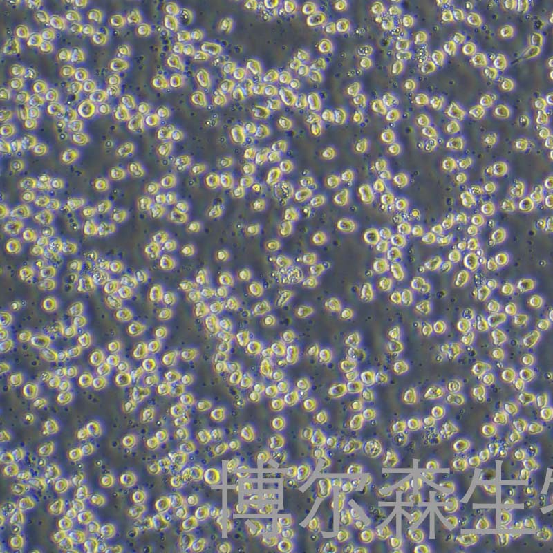 KO52（人白血病细胞）