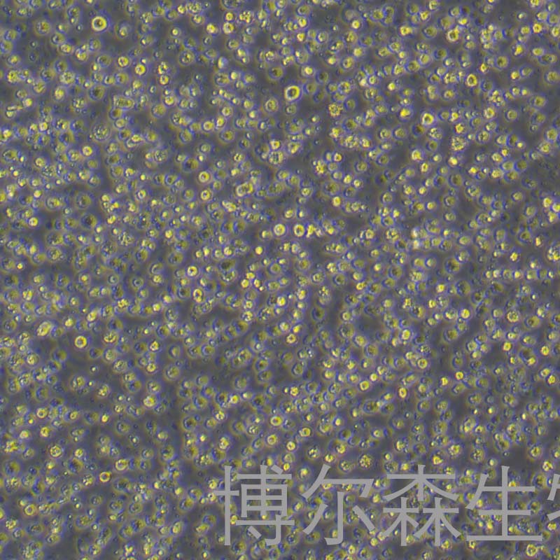 Expi293F（人胚肾细胞）