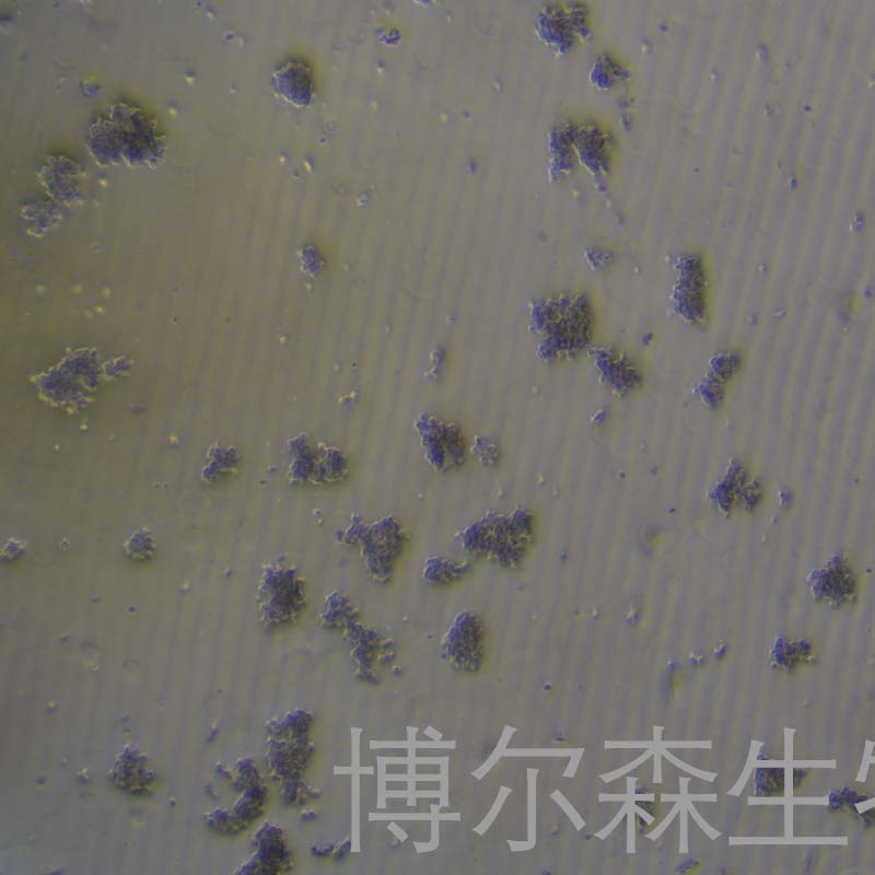 DL-40（人大细胞淋巴瘤）